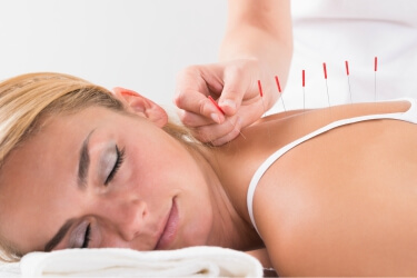 Acupuncture Service In Bakersfield